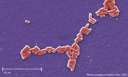 Pink colored EM of E. coli